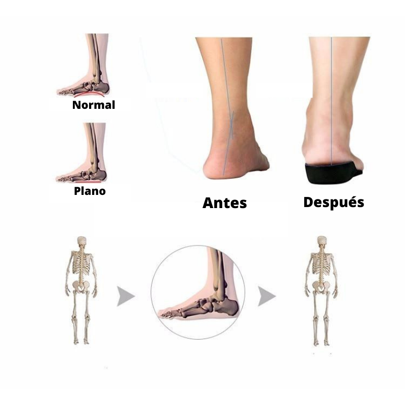 Plantilla Ortopédica Depormex™